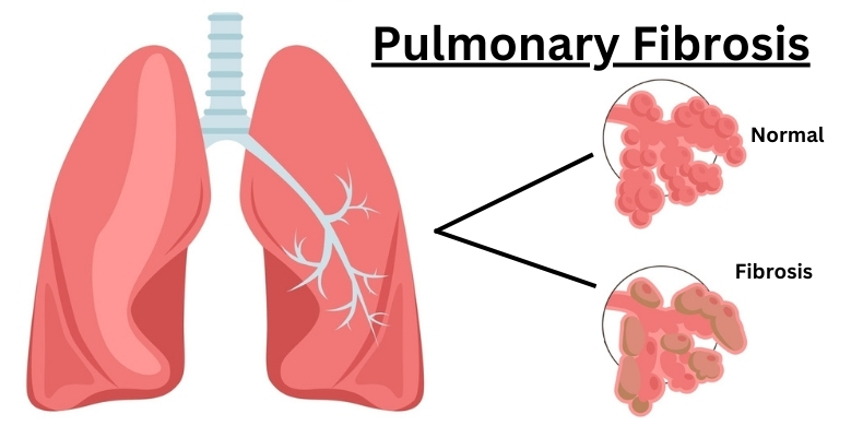 Disease 7